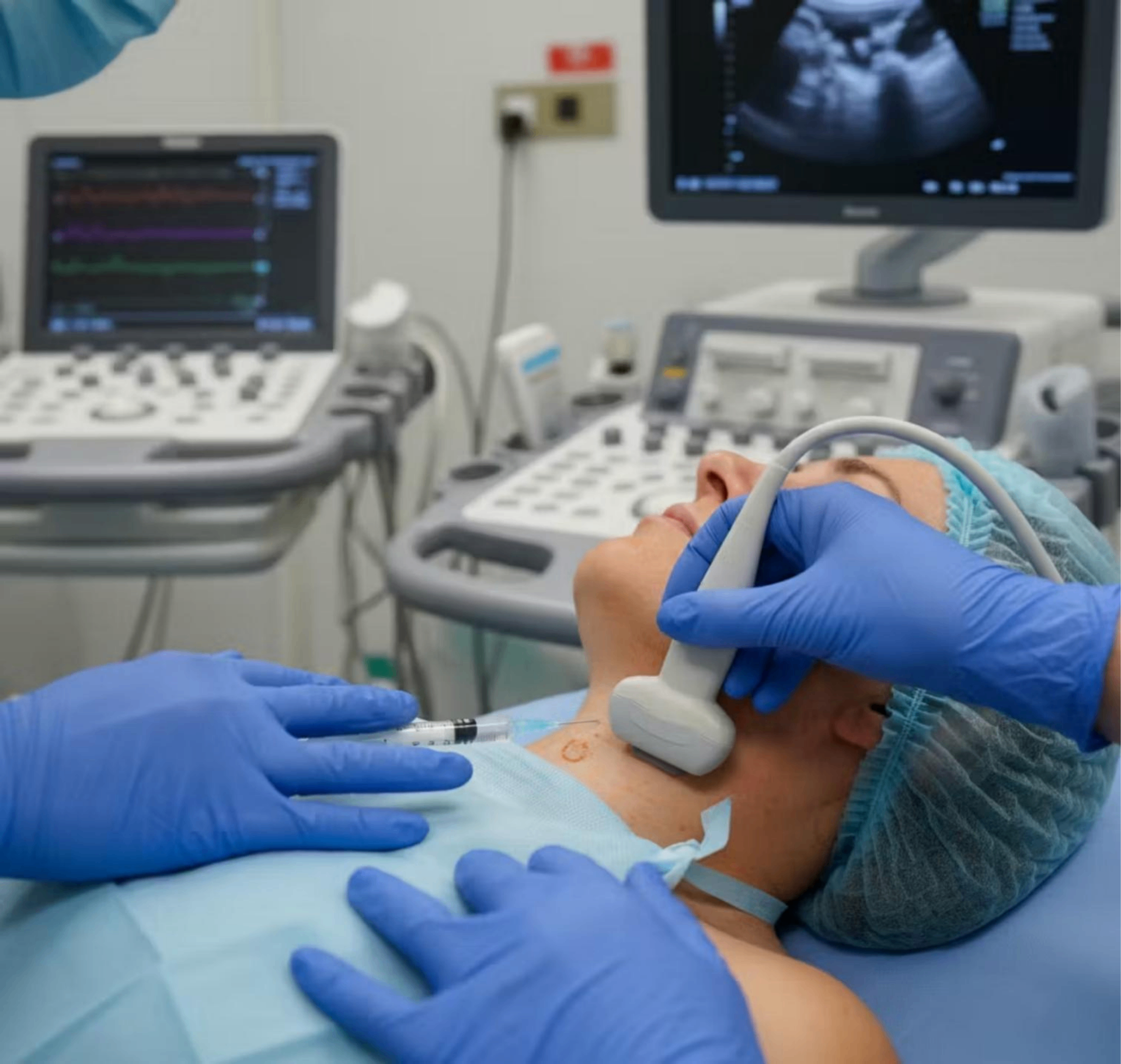 Stellate Ganglion Block: A Paradigm Shift